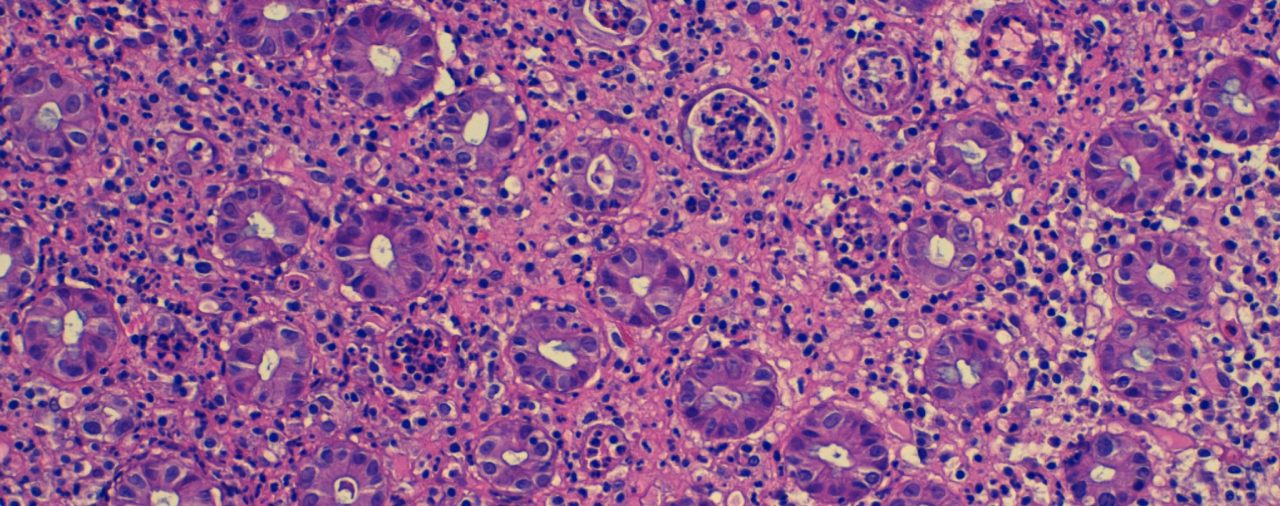 El patólogo: un médico invisible?